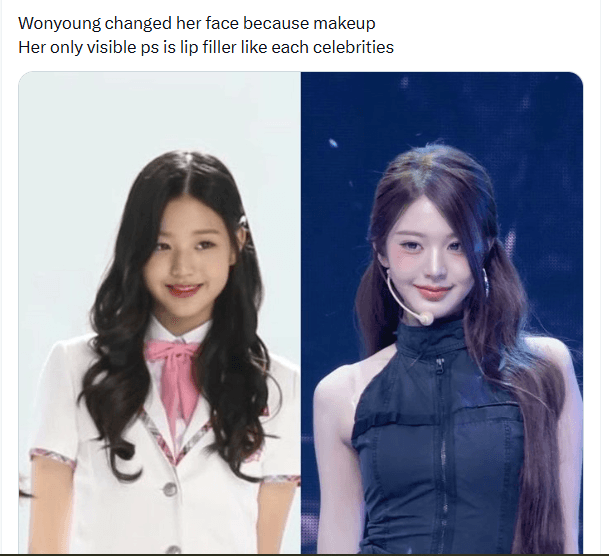 Social media comments debating Wonyoung’s potential lip filler usage