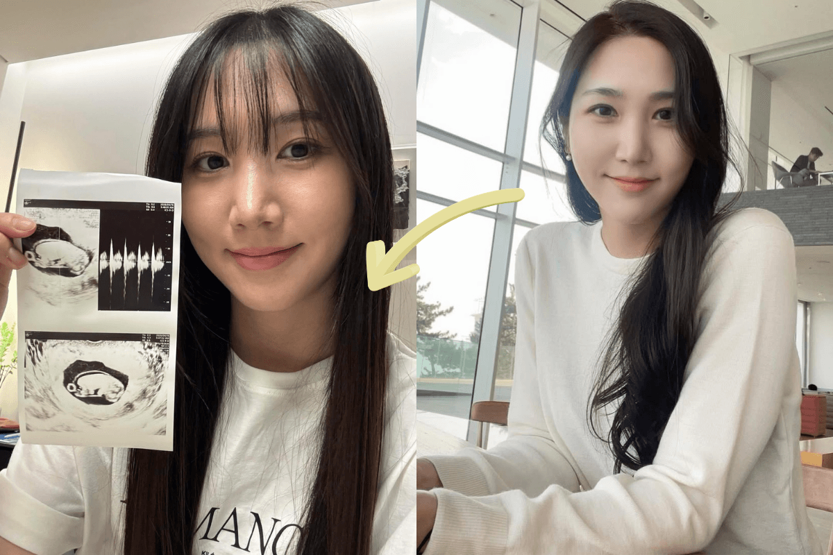 Read more about the article Former Apink member Yoo-kyung Shares Pregnancy Announcement